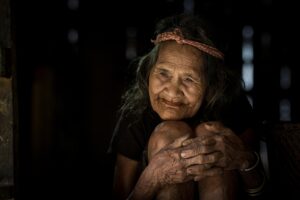 ニキビを悪化させる砂糖と油の関係とは？