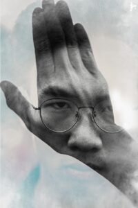 二重整形の保証期間はどれくらい？